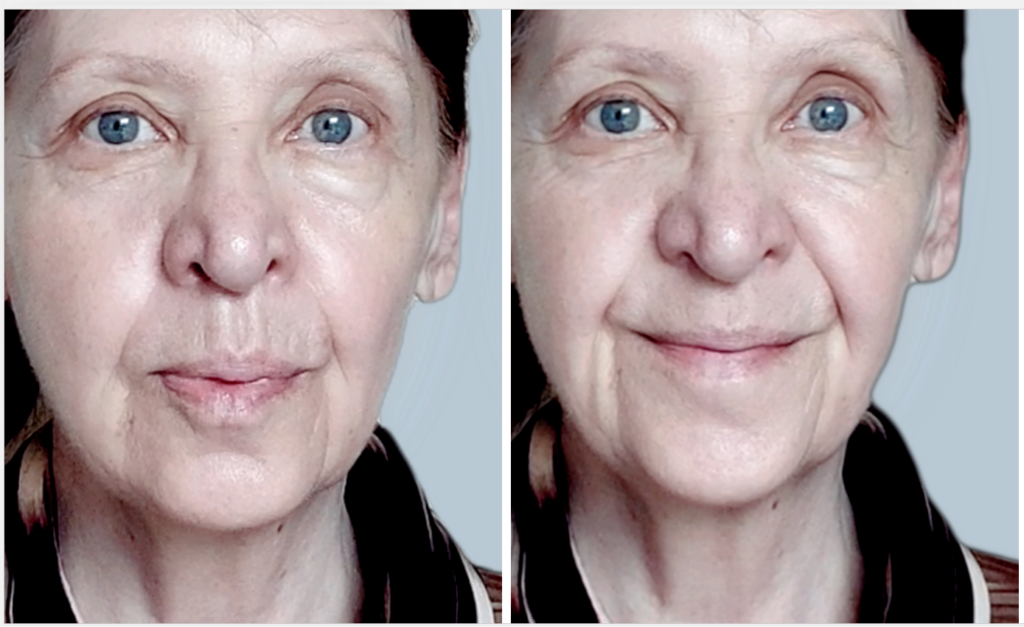woman after 1 year of concentration method A woman after one year of the positive concentration method.