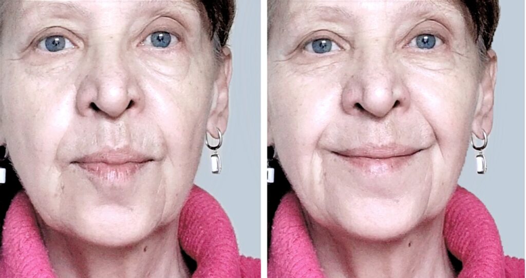 womans appearance before starting facial massage sessions A woman's appearance before starting self-facial massage sessions.